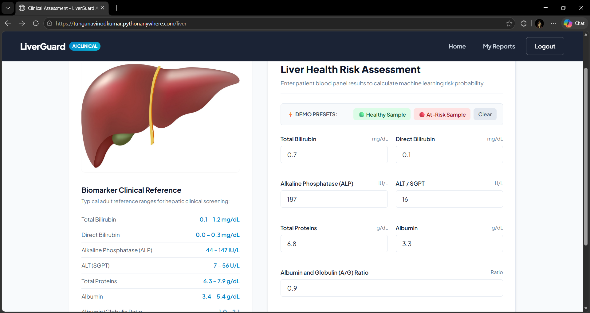 Liver Disease Predictor project screenshot